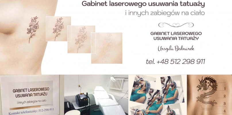 Urszula Bednarczyk - Laserowe usuwanie tatuaży i inne zabiegi 