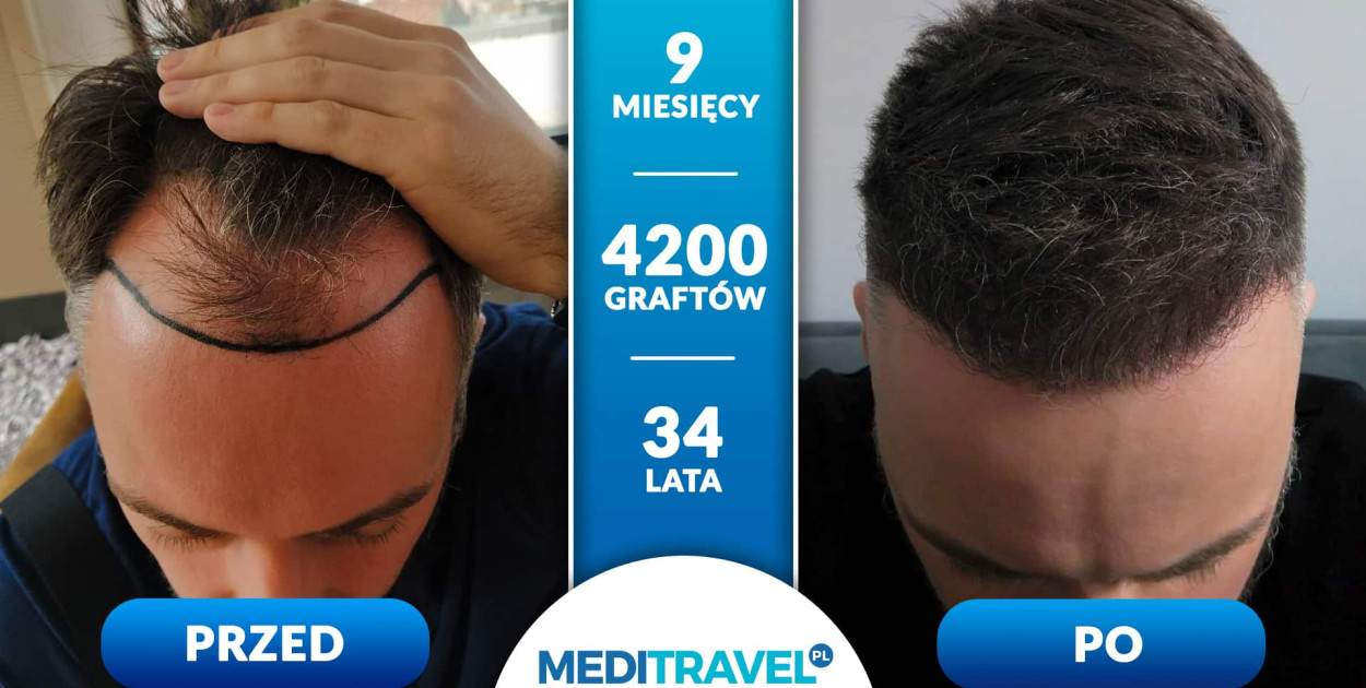 fot: materiał partnera | meditravel.pl
